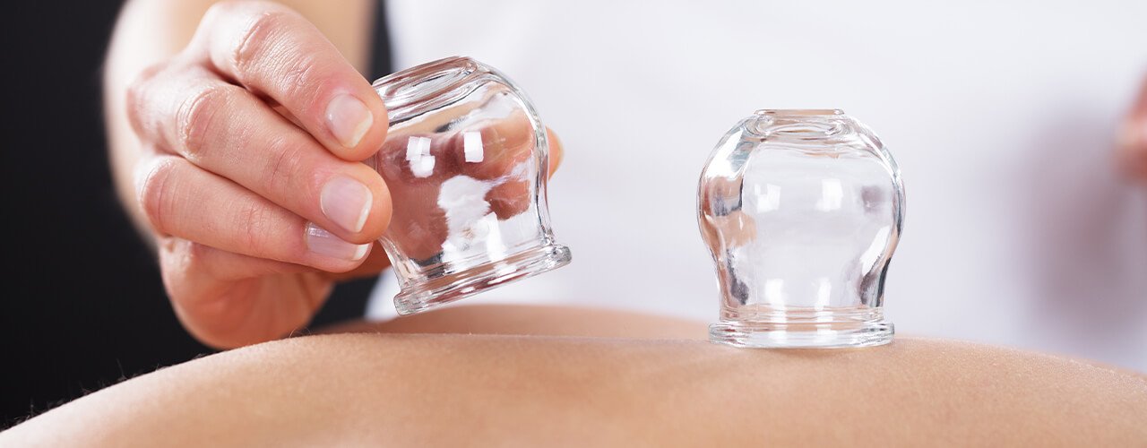Cupping-Therapy